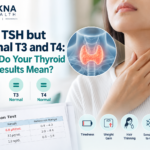 High TSH with normal T3 and T4 thyroid test results